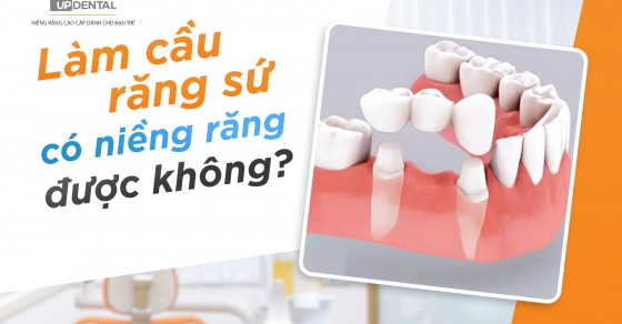 Làm cầu răng sứ có những lợi ích gì so với các phương pháp phục hình răng khác?

