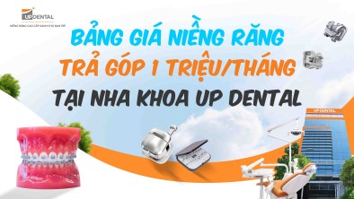 Bảng giá niềng răng trả góp 1 triệu/tháng tại nha khoa Up Dental