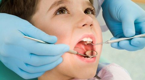 Hướng dẫn vệ sinh răng miệng và các lưu ý khi niềng răng
