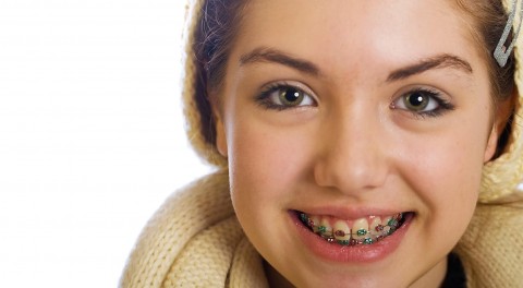 Kế hoạch điều trị cho trẻ 6 - 12 tuổi để có hàm răng đẹp