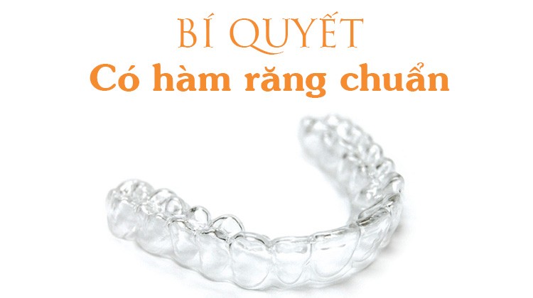 Niềng răng trong suốt – Bí quyết có một hàm răng chuẩn mà vẫn thẩm mỹ