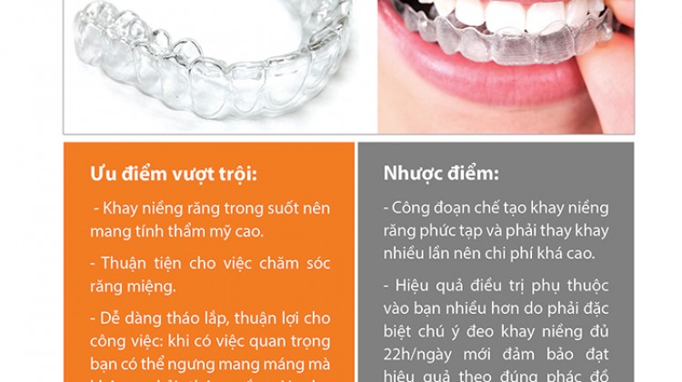 Bảng giá niềng răng không mắc cài eCligner