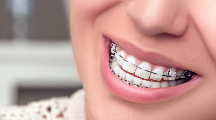 Cái răng cái tóc là góc con người