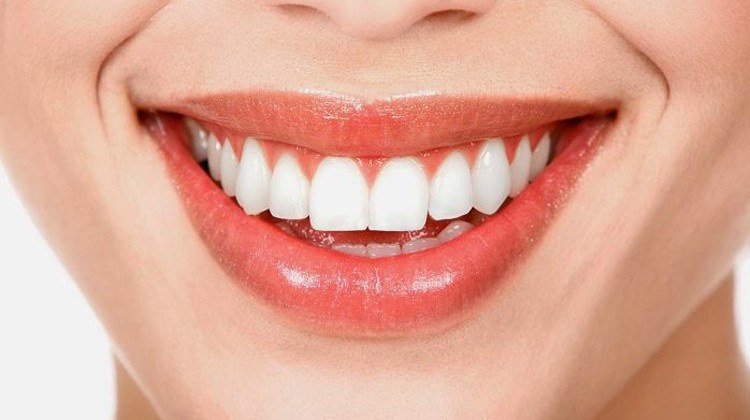 Khám phá phương pháp chỉnh răng móm tại Up Dental