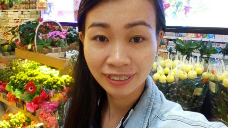 Nhật ký niềng răng của Kim Cương (30 tuổi)