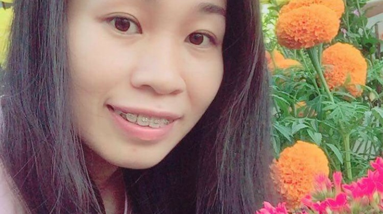 Niềng răng mắc cài nhưng vẫn tự tin cười tươi - Kim Cương