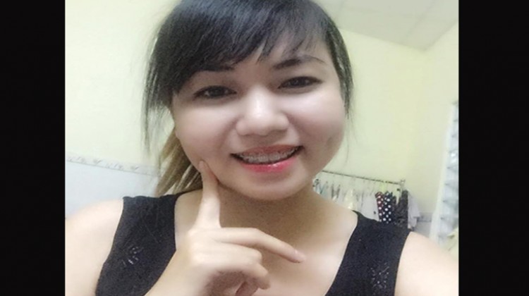 Niềng răng thoải mái, tự tin khoe mắc cài