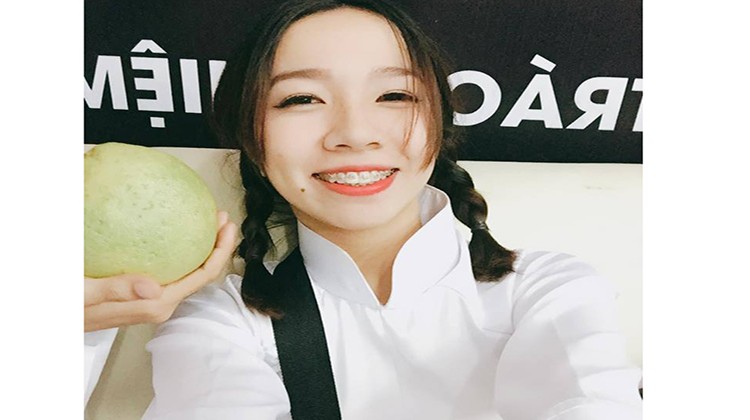 Review kết quả niềng răng sau 5 tháng tại nha khoa Up Dental - Nguyễn Thị Hiền