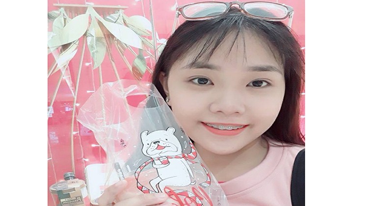 Niềng răng vẫn hát hay như ca sỹ - Bạn Quách Mỹ Thuận