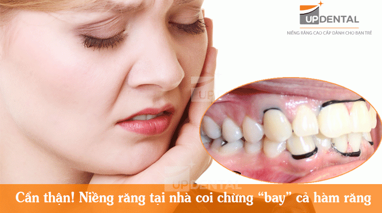 Cẩn thận! Niềng răng tại nhà coi chừng “bay” cả hàm răng