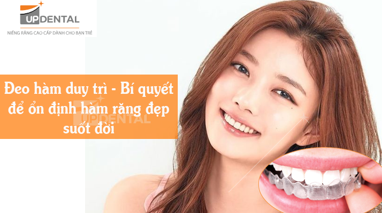 Đeo hàm duy trì – Chặng cuối hành trình chinh phục hàm răng đẹp