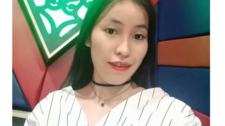 Niềng răng hô với mắc cài kim loại