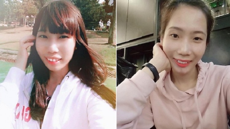 Những lợi ích bất ngờ chỉ niềng răng mới có