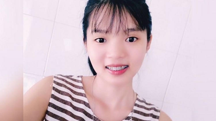 Cô gái 1m52 làm thơ chia sẻ kinh nghiệm niềng răng