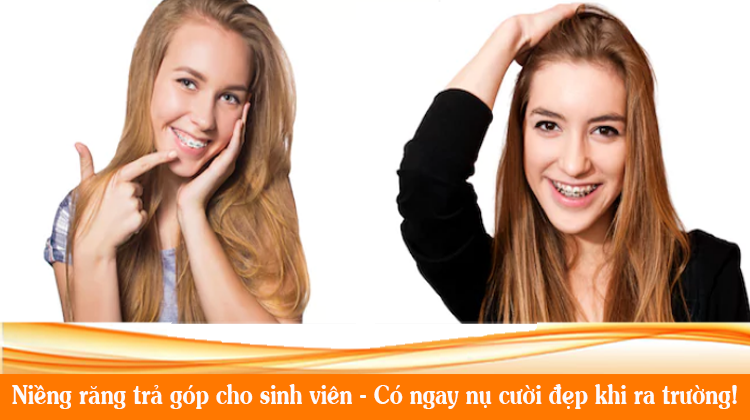 Niềng răng trả góp cho sinh viên tp.HCM