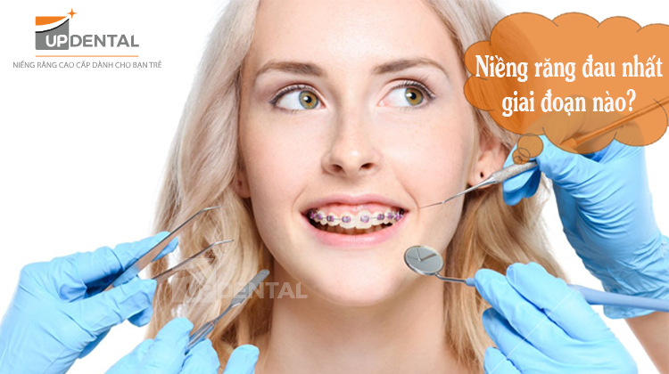 Niềng răng đau cỡ nào? Cách giảm đau khi niềng răng