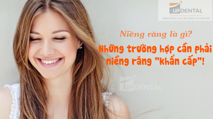 Niềng răng là gì? Trường hợp cần niềng răng khẩn cấp