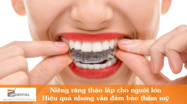 Niềng răng tháo lắp hiệu quả và thẩm mỹ