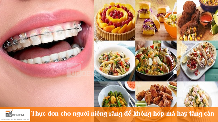 Thực đơn cho người niềng răng để không hóp má hay tăng cân