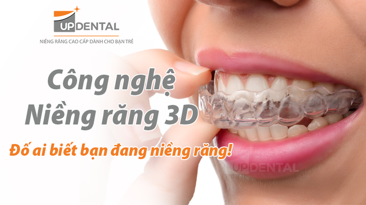 Công nghệ niềng răng 3D - Đố ai biết bạn đang niềng răng