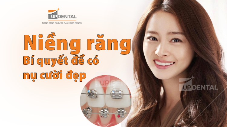 Chỉnh nha niềng răng - bí quyết có nụ cười đẹp, hết Hô, Móm...