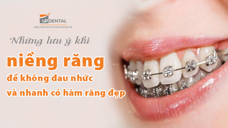 Những lưu ý khi niềng răng để không đau nhức và nhanh có hàm răng đẹp