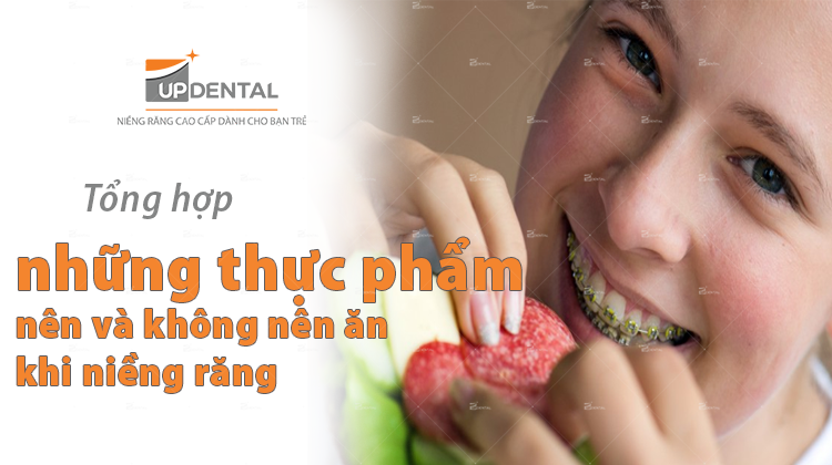 Tổng hợp thực phẩm nên và không nên ăn khi niềng răng
