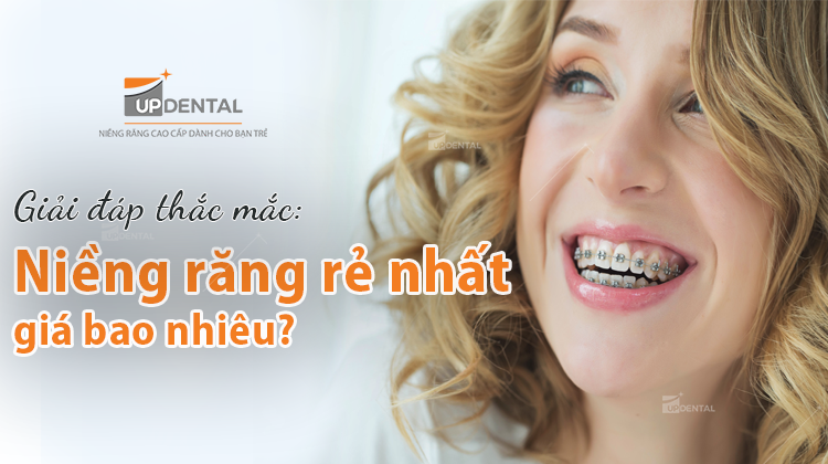 Niềng răng rẻ nhất bao nhiêu tiền?
