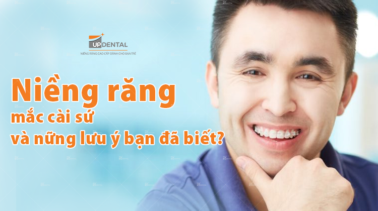 Niềng răng mắc cài sứ và những lưu ý quan trọng