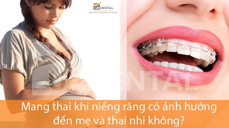 Mang thai khi niềng răng có ảnh hưởng đến mẹ và thai nhi không?