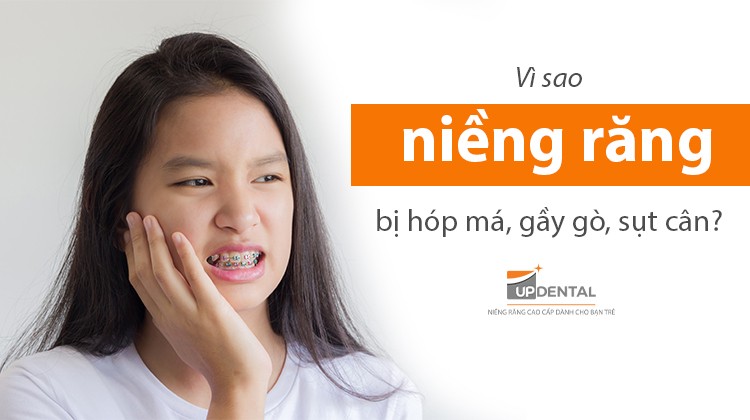 Niềng răng có bị hóp má? Lý do bạn trông gầy gò, hóp má khi đeo niềng