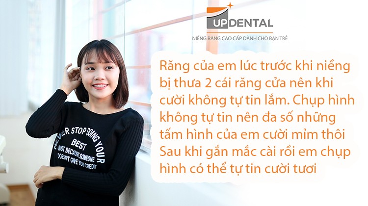 Nên hay không nên niềng răng - Trải lòng của cô gái tuổi 22 Quách Mỹ Thuận