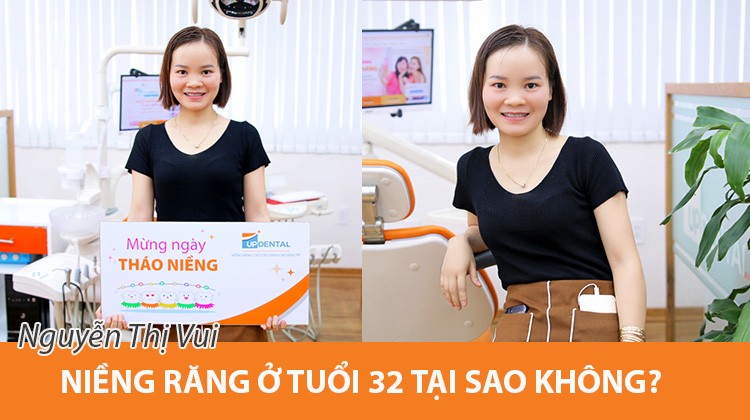 Niềng răng ở tuổi 32 tại sao không? - Review khách hàng Nguyễn Thị Vui
