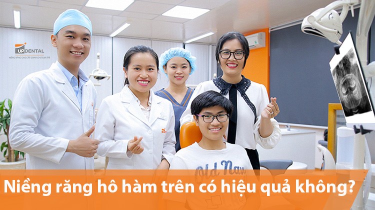 Niềng răng hô hàm trên có hiệu quả không?
