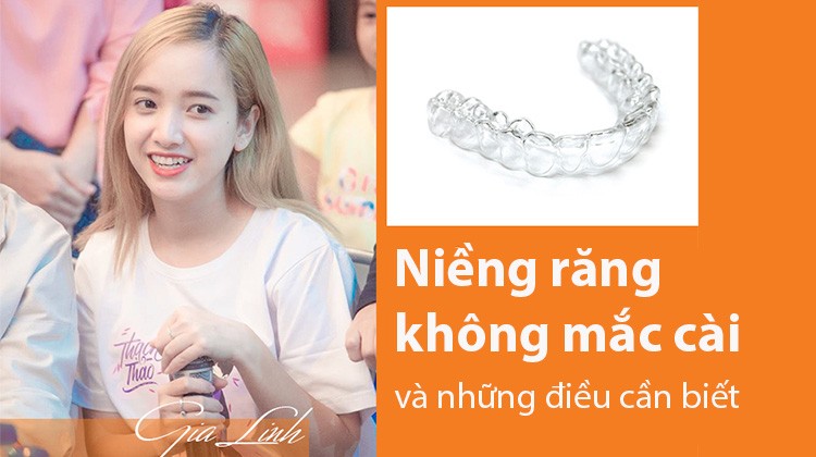Niềng răng không mắc cài giá bao nhiêu và những điều cần biết