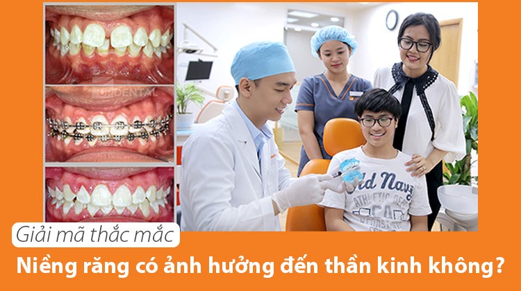 Giải mã thắc mắc niềng răng có ảnh hưởng đến thần kinh không?