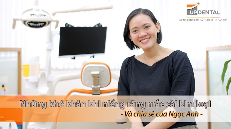 Những khó khăn khi niềng răng mắc cài kim loại - chia sẻ của Ngọc Anh
