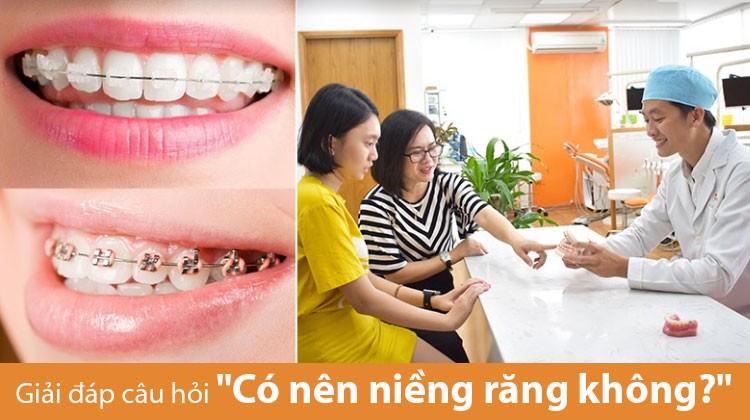 Giải đáp câu hỏi