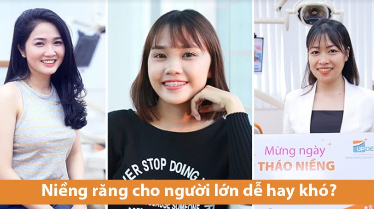 Niềng răng cho người lớn dễ hay khó?