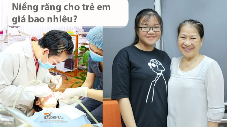 Niềng răng cho trẻ em giá bao nhiêu?