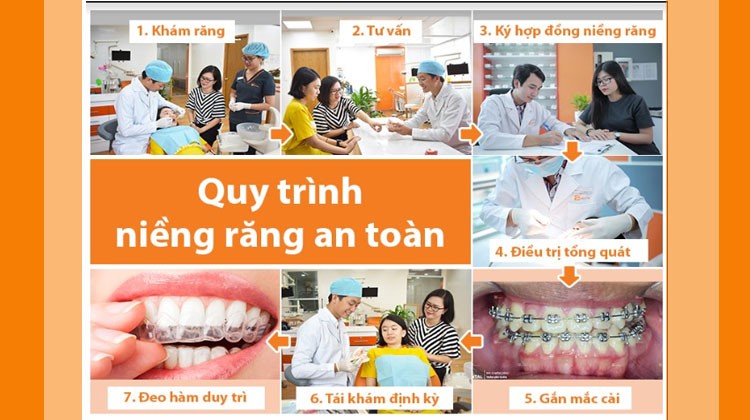 Các bước trong quy trình niềng răng chuẩn Y khoa