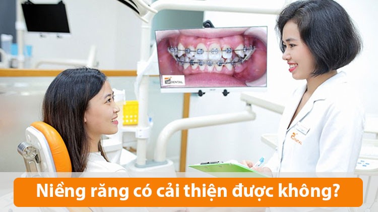 Niềng răng lệch hàm có cải thiện được hàm lệch không?