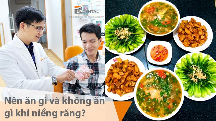 Nên ăn gì và không nên ăn gì khi niềng răng?
