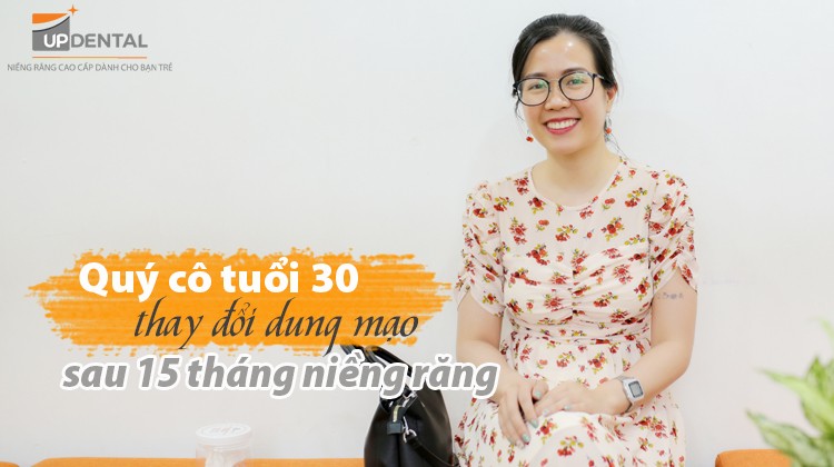 Quý cô tuổi 30 thay đổi dung mạo sau 15 tháng niềng răng