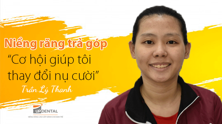 Niềng răng trả góp: Cơ hội giúp tôi thay đổi nụ cười - Khách hàng Lý Thanh