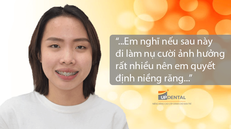 Niềng răng hô hàm tiết kiệm chi phí tại HCM - Phạm Thị Xôn