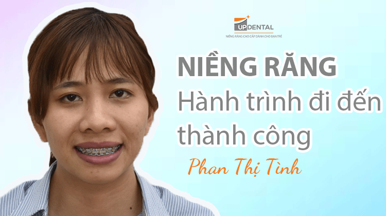 Niềng răng: Hành trình đi đến thành công - Phan Thị Tình