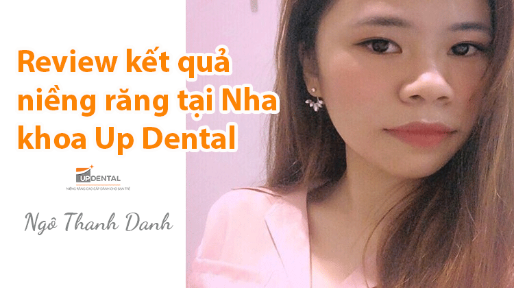 Review kết quả niềng răng tại Nha khoa Up Dental - Thanh Danh
