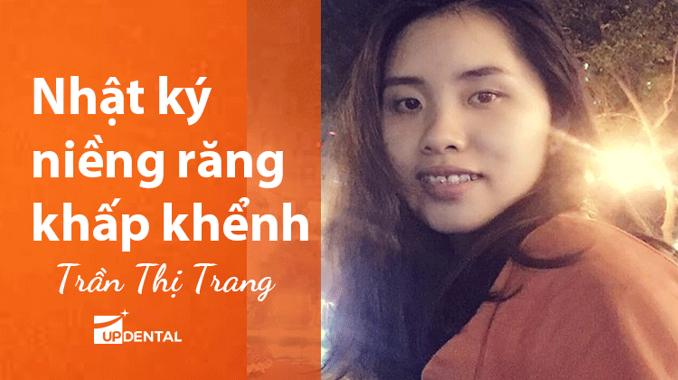 Nhật ký niềng răng khấp khểnh của Trần Thị Trang
