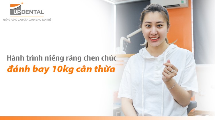 Hành trình niềng răng chen chúc đánh bay 10kg cân thừa